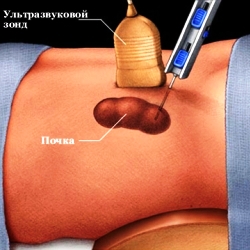 рисунок биопсии