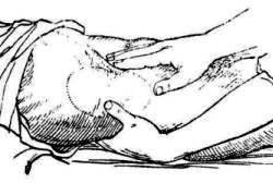 пальпация почки - рисунок