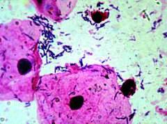 мазок из уретры