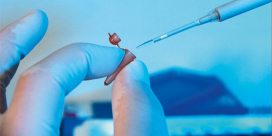 ПЦР диагностика