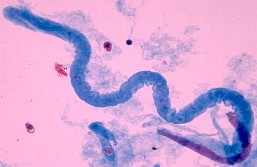 цилиндры в моче