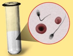 гемоспермия - кровь в сперме