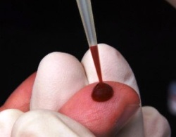 глюкозотолерантный тест