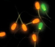 некрозооспермия - фото