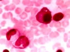 плазматическая клетка - плазмоцит