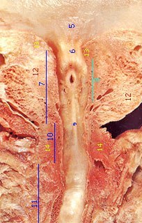 семенной бугорок - фото