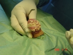 смегма - фото