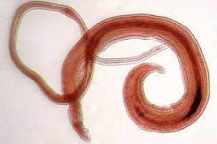 шистосоматоз, бильгарциоз - фото