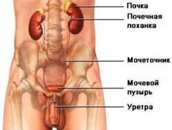 мочеточник и его болезни - рисунок