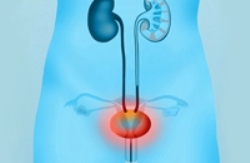 интерстициальный цистит - фото