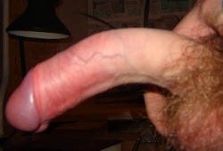 искривление полового члена - фото