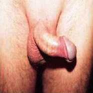 кривой член - фото