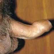 кривой пенис - фото