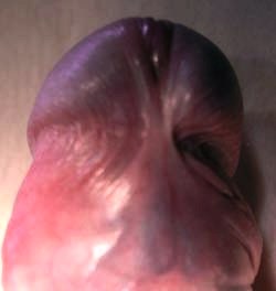 короткая уздечка