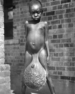 гигантская мошонка - фото