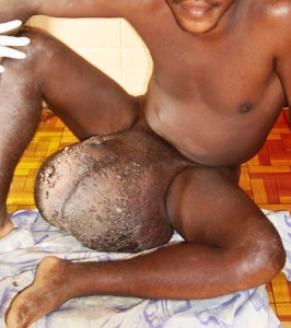 большая мошонка - фото